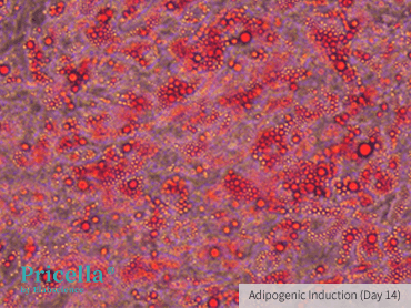 Oil Red O Staining, 200×