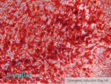 Alizarin Red Staining, 100×