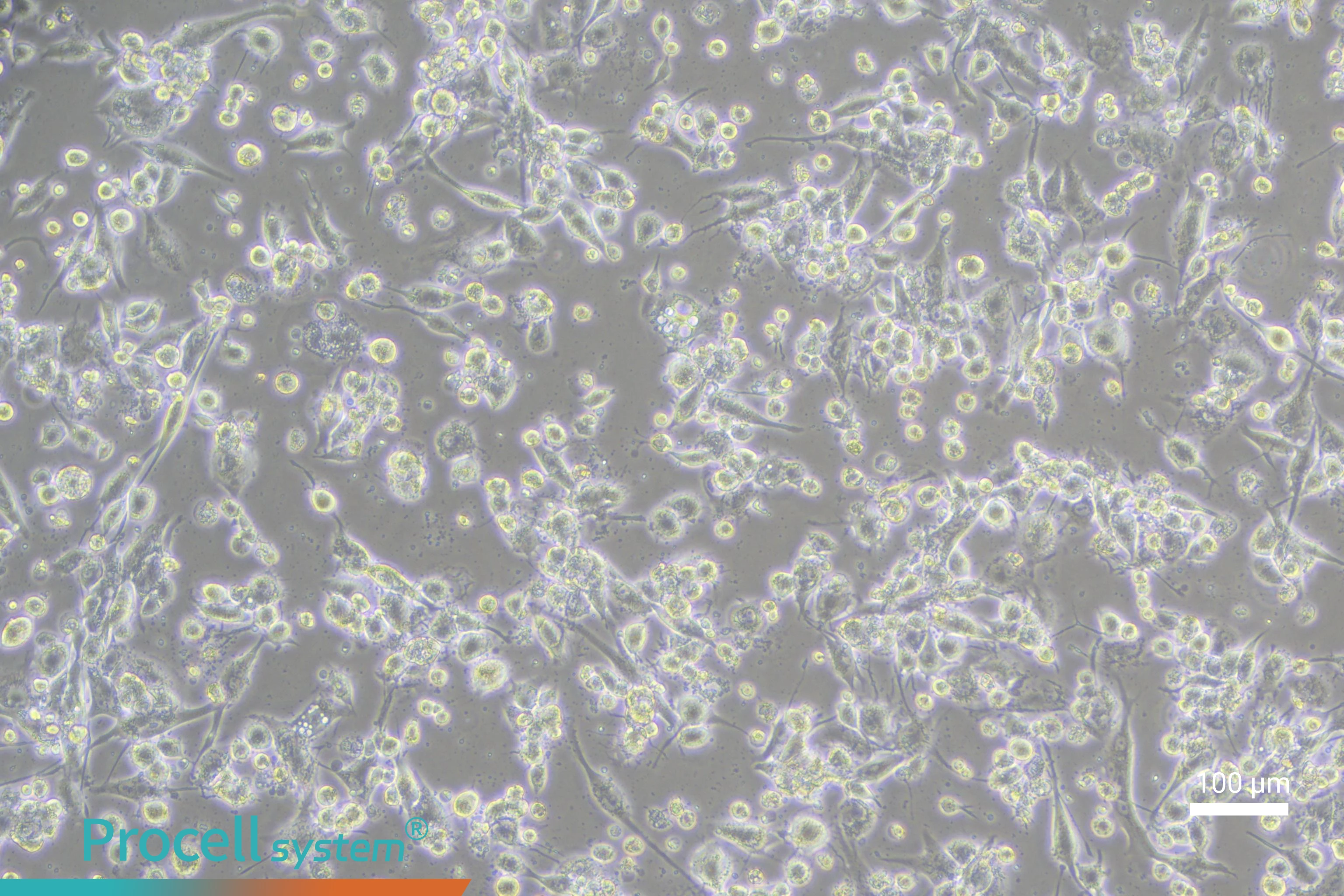Essential Guide to THP-1 Cell Culture, Differentiation, and Macrophage Polarization-4