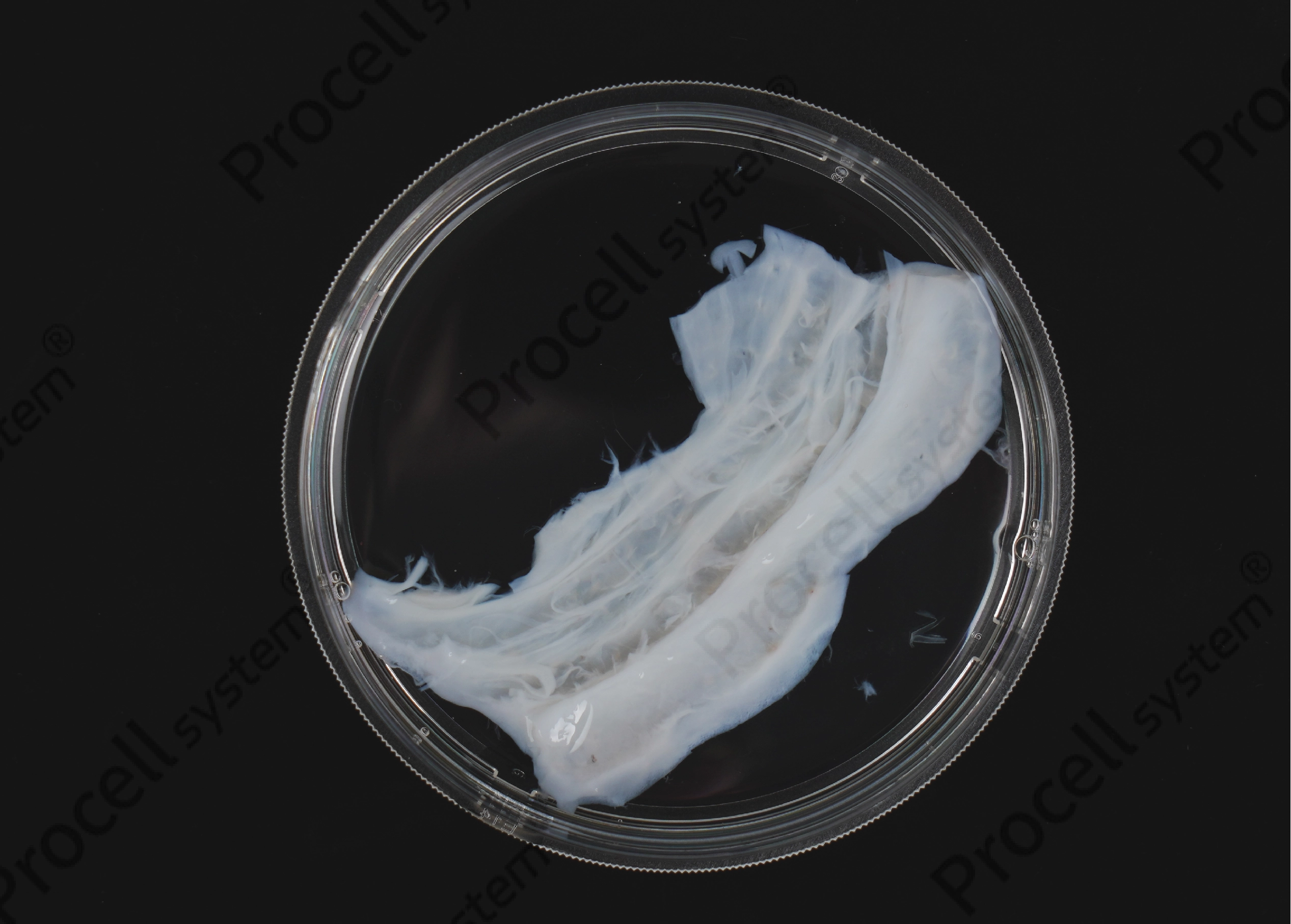 Key Details Not to Overlook in the Primary Isolation and Characterization of hUC-MSCs-1