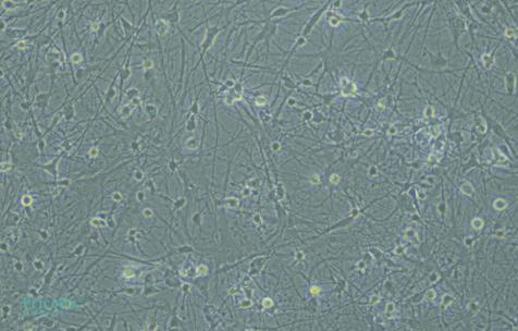 Decoding Astrocytes: Essential Techniques for Primary Cell Isolation-5