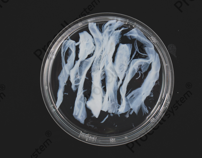 Key Details Not to Overlook in the Primary Isolation and Characterization of hUC-MSCs-2