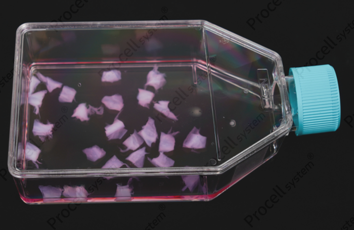 Key Details Not to Overlook in the Primary Isolation and Characterization of hUC-MSCs-4