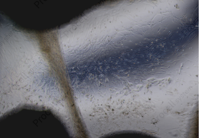 Key Details Not to Overlook in the Primary Isolation and Characterization of hUC-MSCs-5
