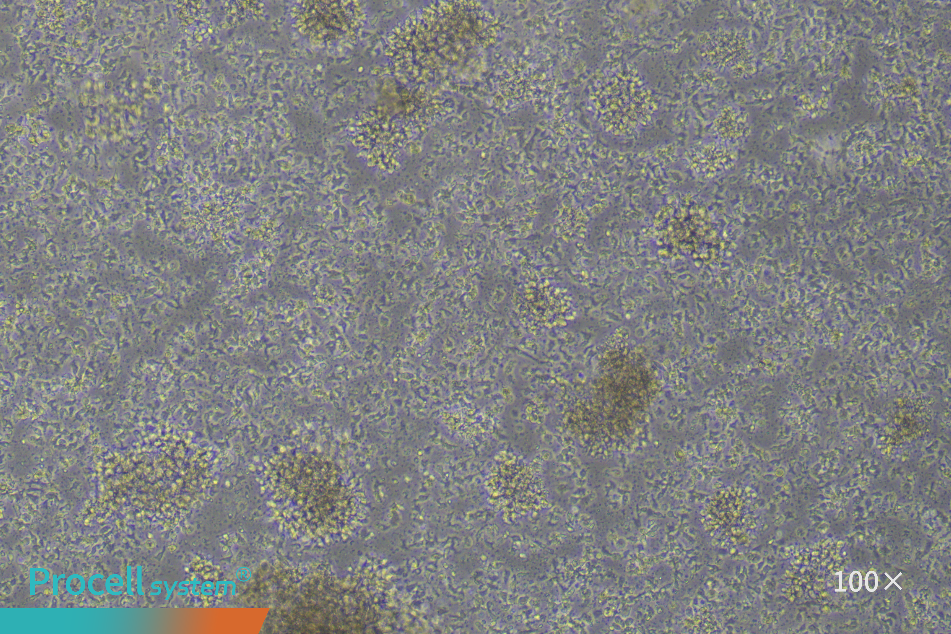 Practical Strategies for NK Cell Culture and Cryopreservation-3