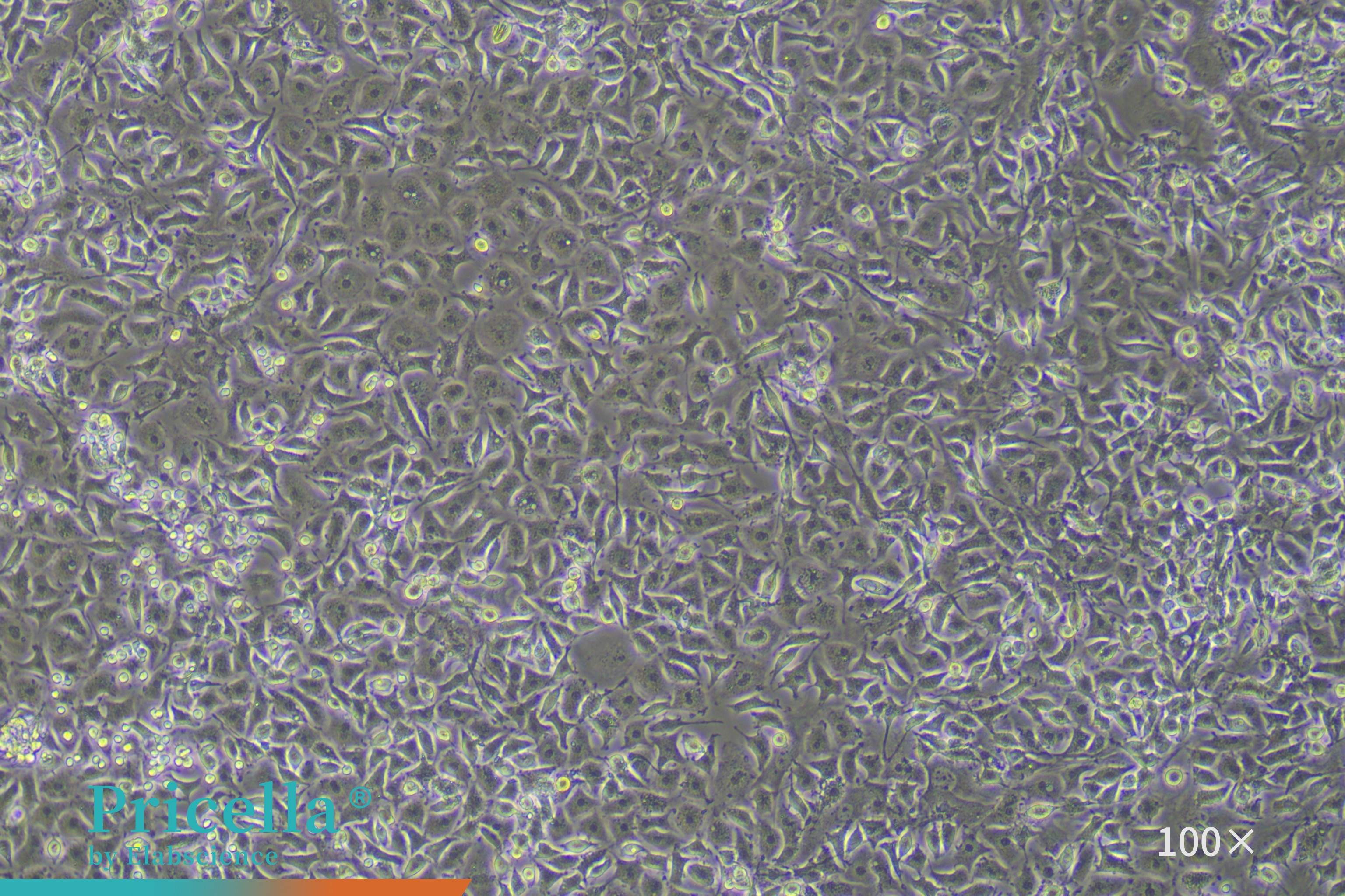 Rat bone marrow-derived endothelial progenitor cells cultured for 9 days
