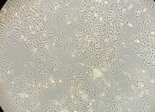 Representative morphology of cellular bacterial contamination-1
