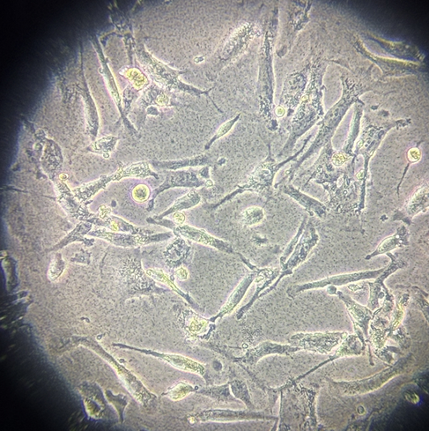 Representative morphology of cellular bacterial contamination-2