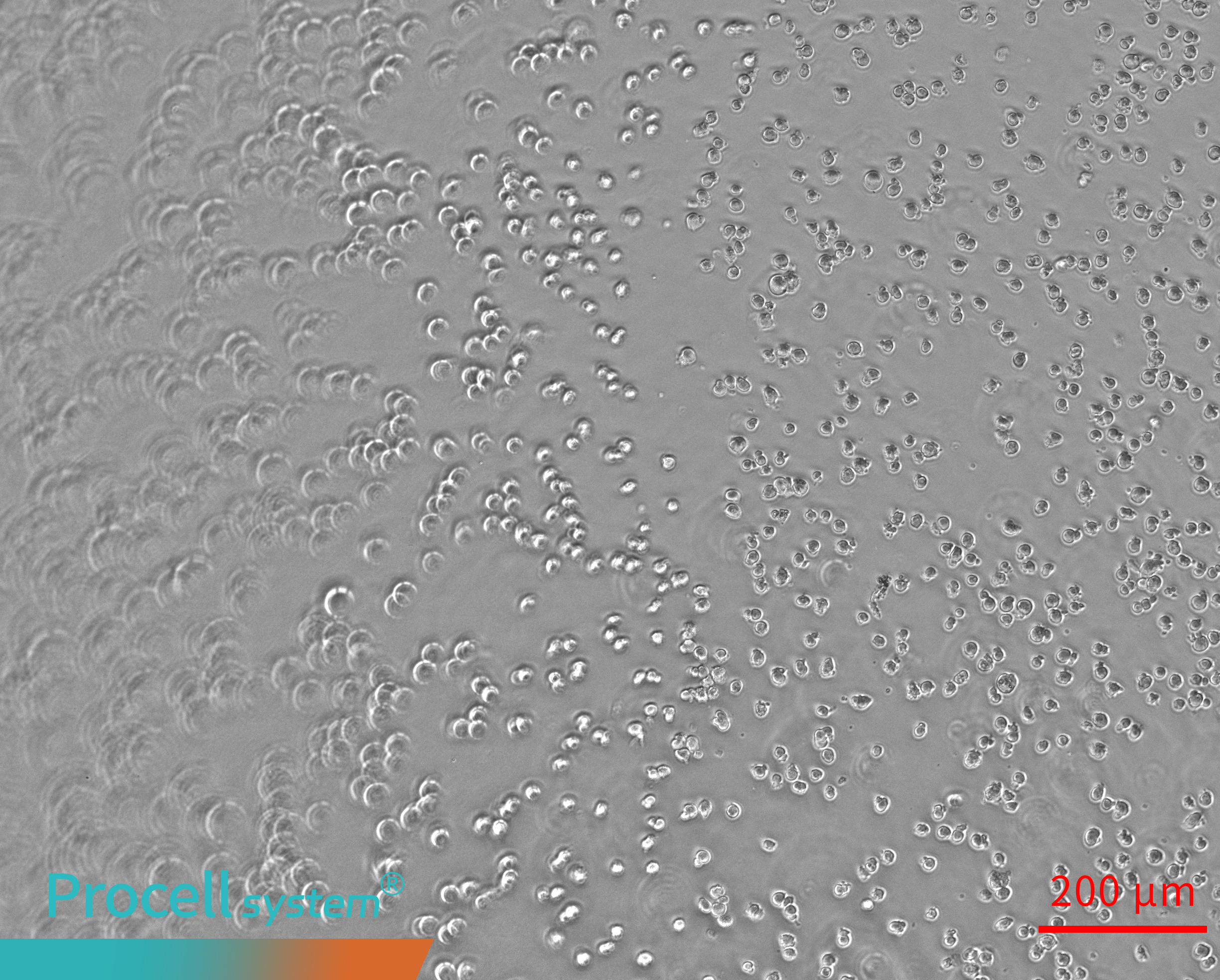 Uneven Matrigel surfaces cause spatial bias in Angiogenesis 0h