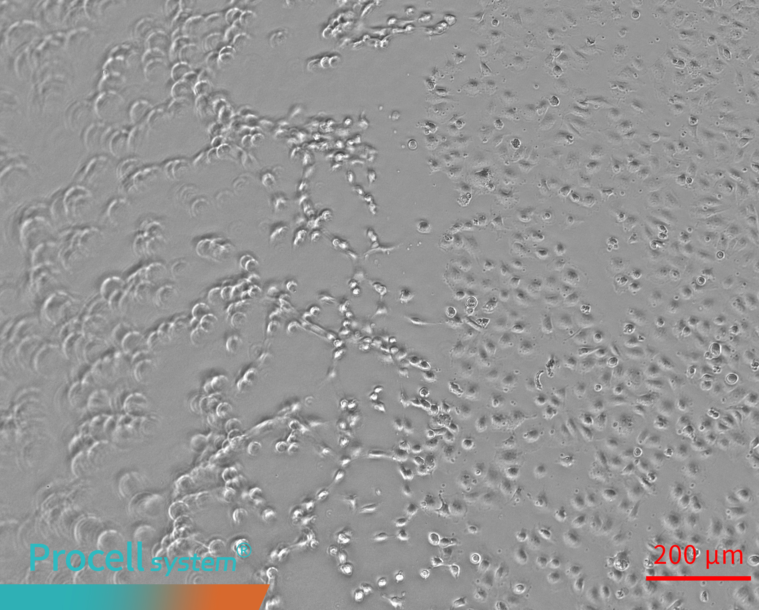 Uneven Matrigel surfaces cause spatial bias in Angiogenesis 2h