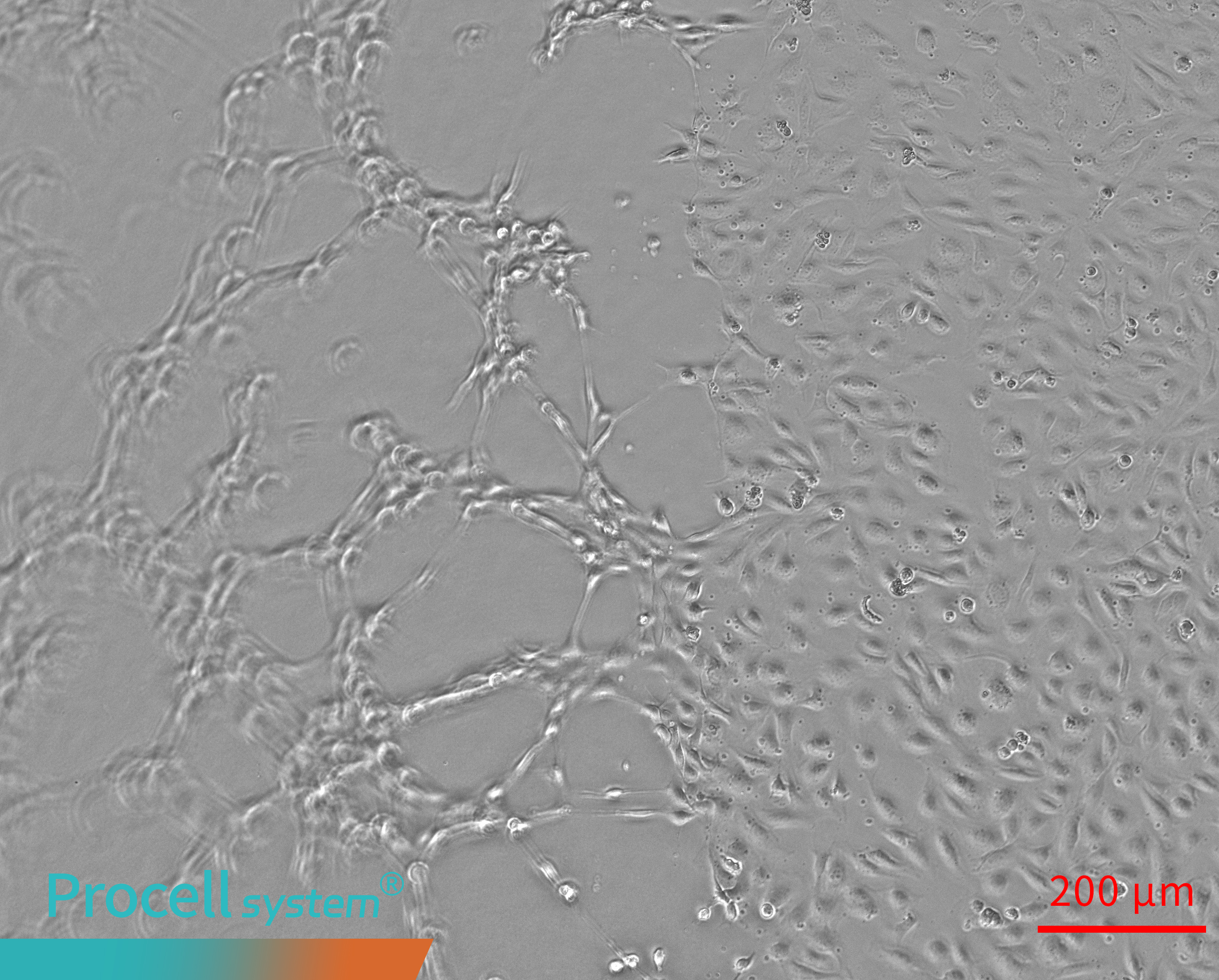 Uneven Matrigel surfaces cause spatial bias in Angiogenesis 4h