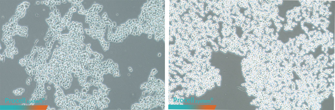 Adherent Cell Dissociation: Selection and Optimization of Reagents and Digestion Endpoints-1