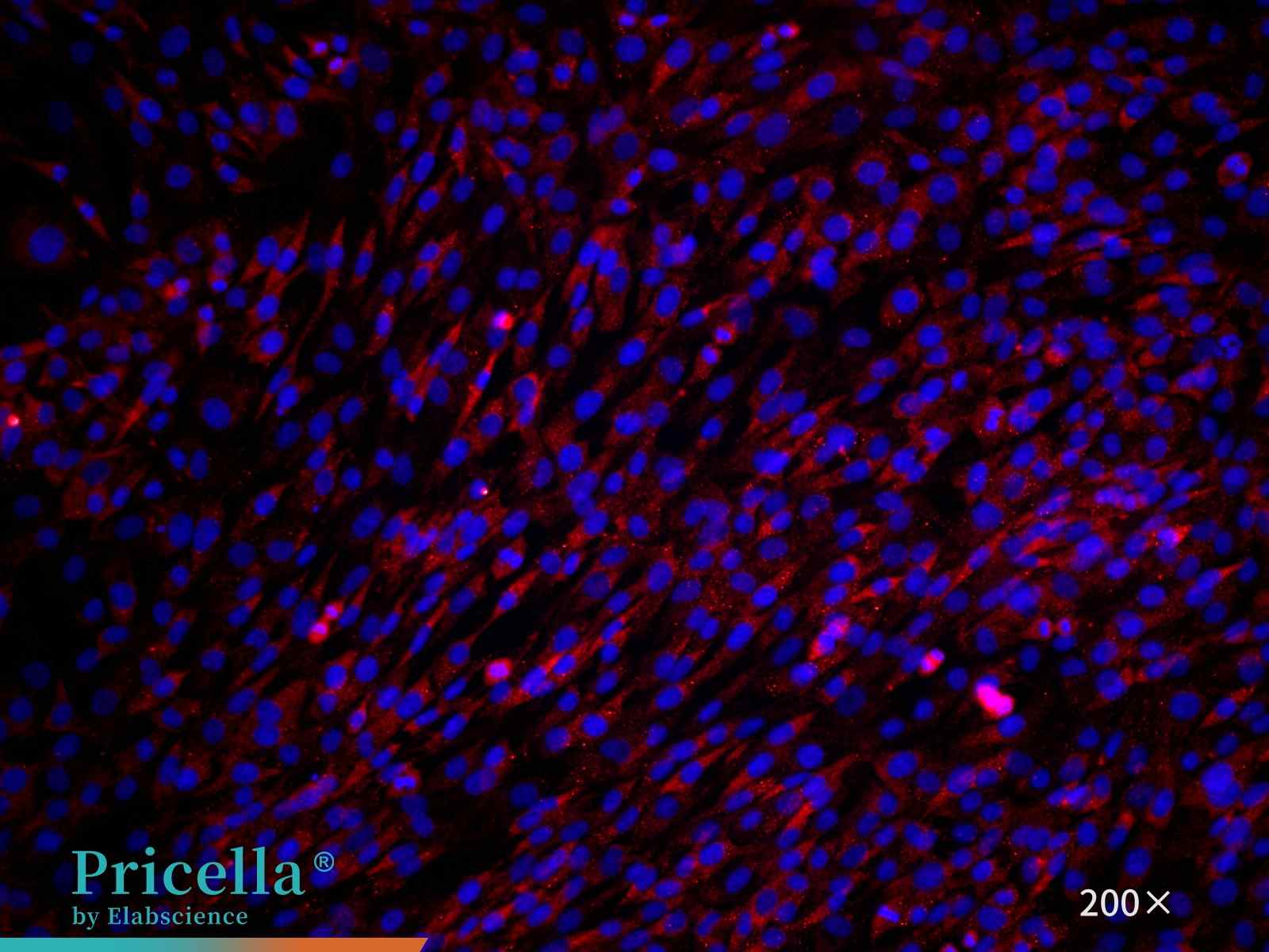 Rat temporomandibular joint chondrocytes,Collagen II, 200x