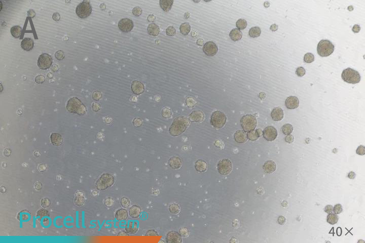 A Tumor Sphere Assay for Cancer Stem Cells, SUM159PT, 40X