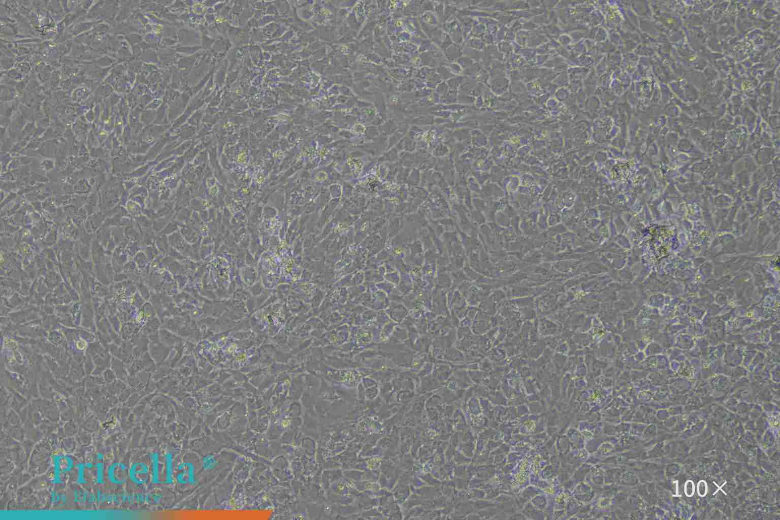 Temporomandibular Joint Chondrocyte Cells（100X）