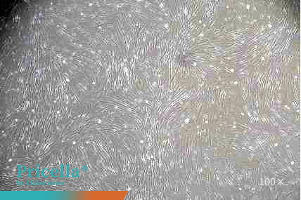 human adipose MSCs  P5-100X