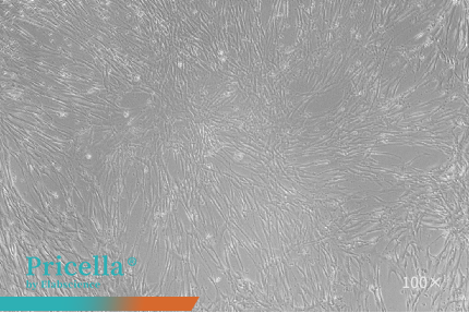human adipose MSCs  P5-100X