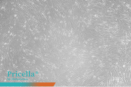 human umbilical cord MSCs P15-100X