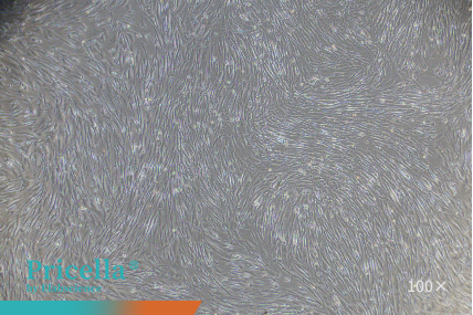 human umbilical cord MSCs P5-100X