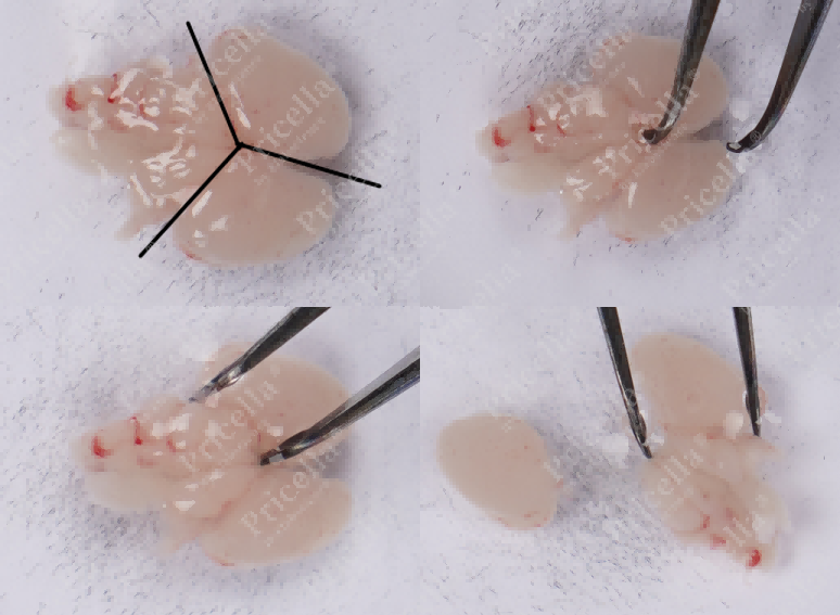 Separate cerebellum and brain