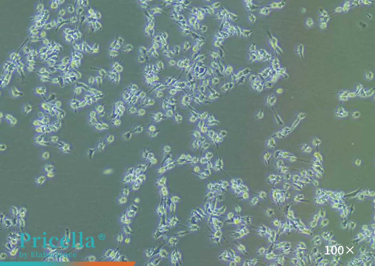 Rat bone marrow mesenchymal stem cells（after digestion）