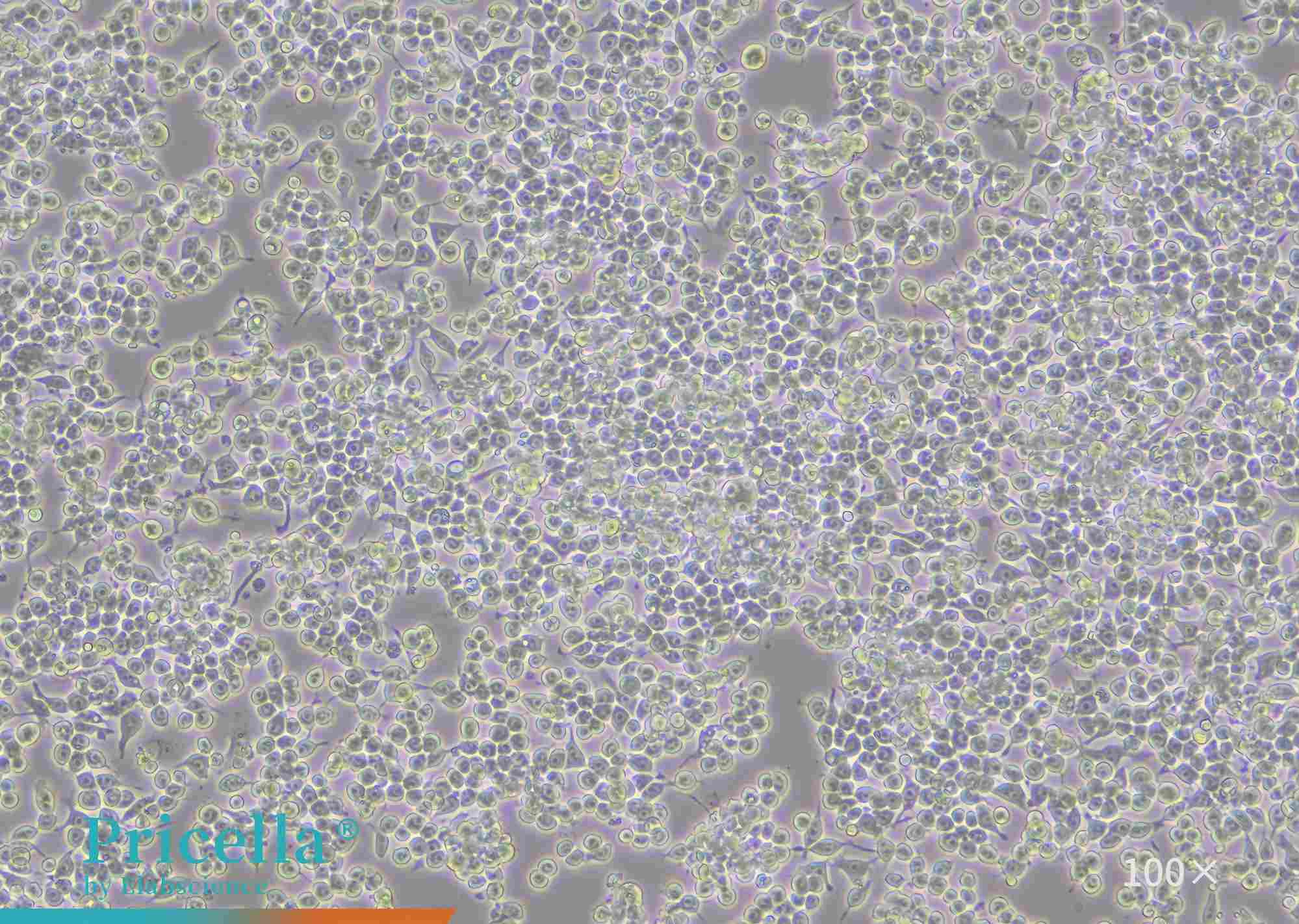 Transduction Protocol for RAW 264.7 Cells: A Complete, Ready-to-use Workflow-2