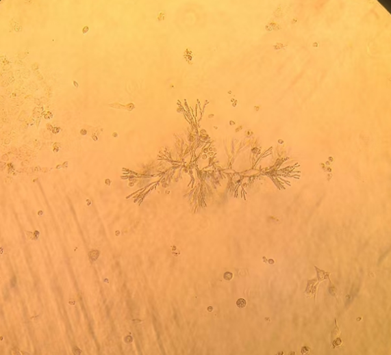 Representative morphology of cellular fungal contamination-1