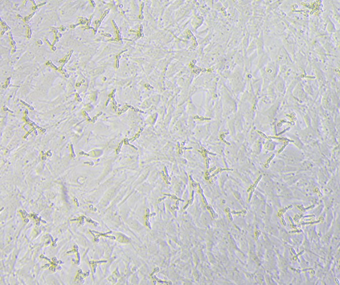 Representative morphology of cellular fungal contamination-2