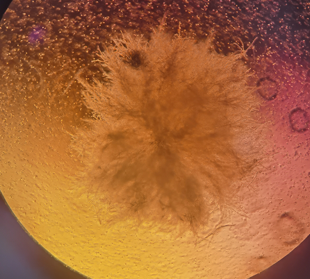 Representative morphology of cellular fungal contamination-3