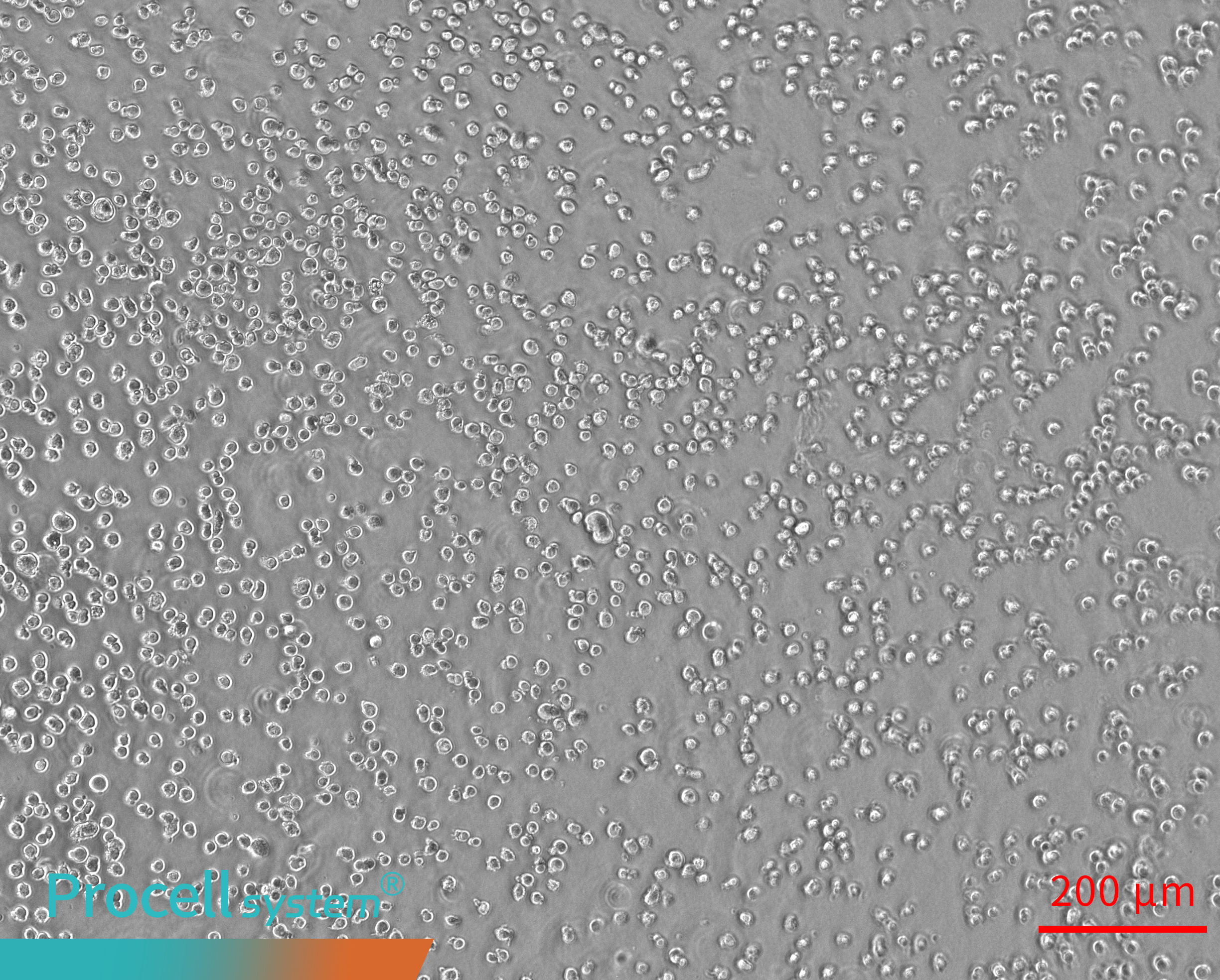 Uneven cell seeding results in discontinuous Angiogenesis 0h