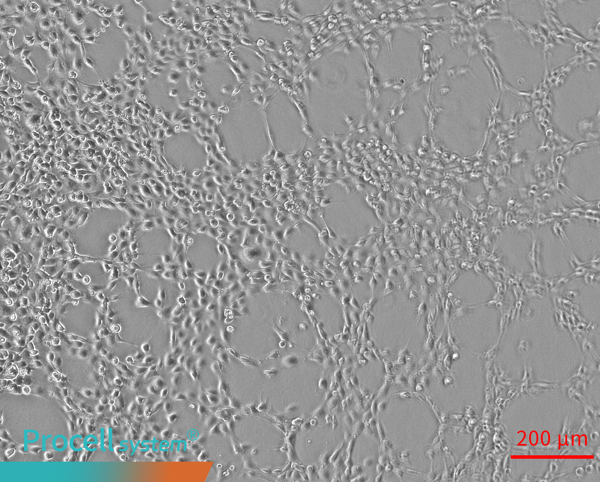 Uneven cell seeding results in discontinuous Angiogenesis 2h
