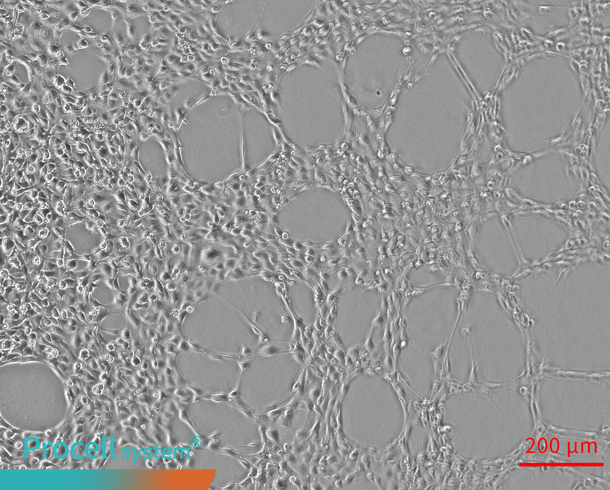 Uneven cell seeding results in discontinuous Angiogenesis 4h
