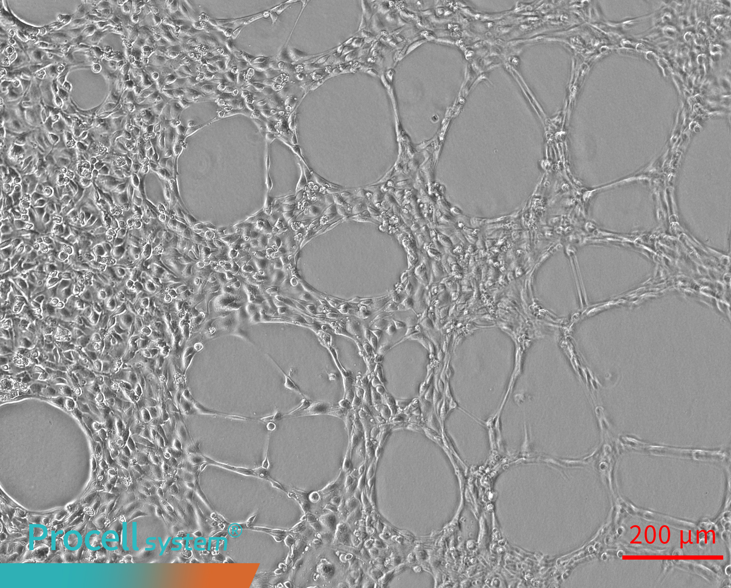 Uneven cell seeding results in discontinuous Angiogenesis 6h