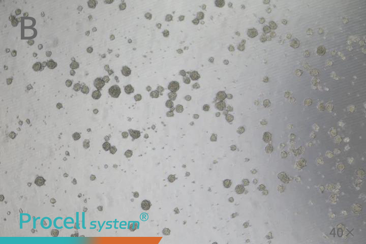 A Tumor Sphere Assay for Cancer Stem Cells, HCT 116, 40X