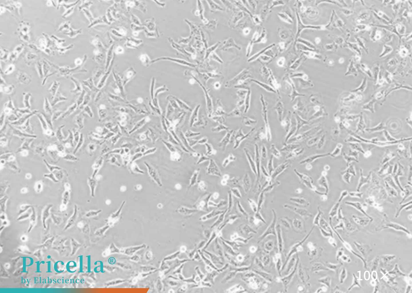 image of HeLa cells figure 1