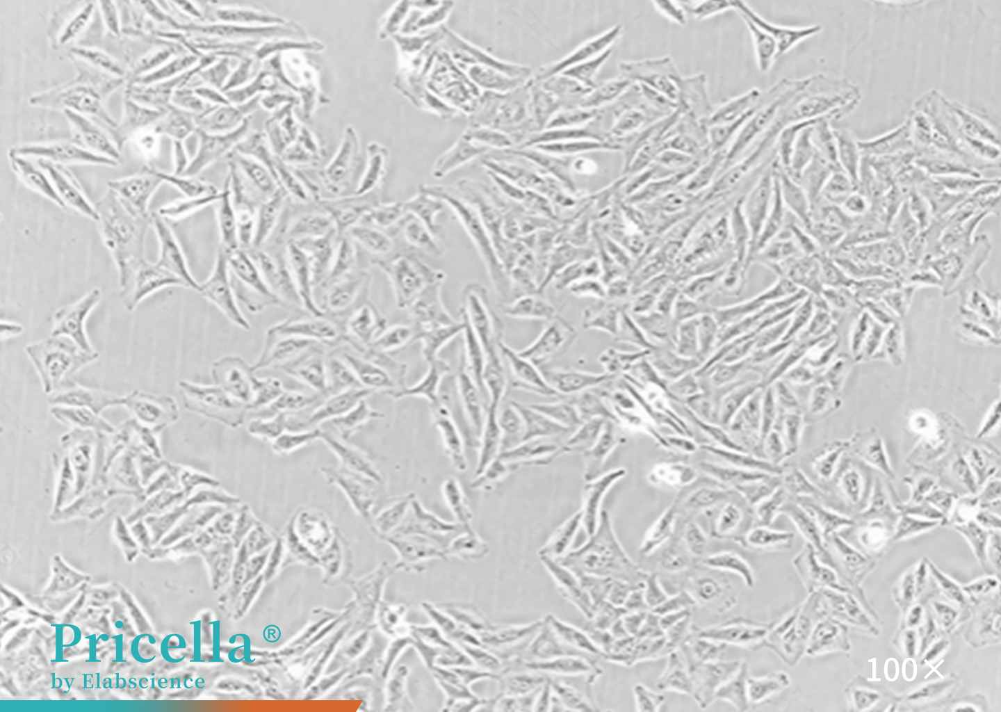 image of HeLa cells figure 2
