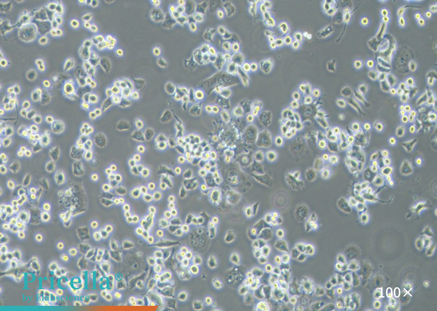 Neuro-2a cells (100x)