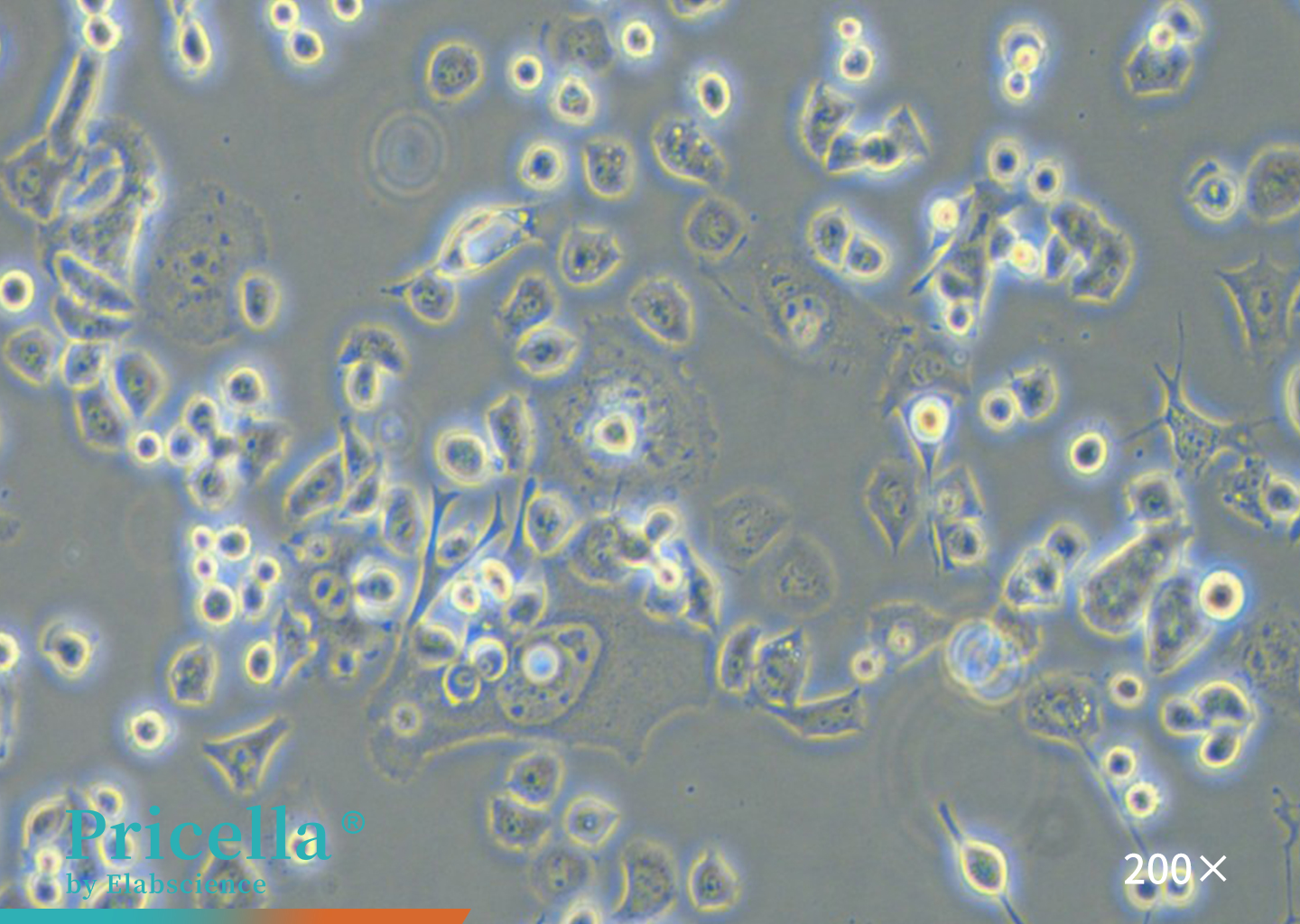 Neuro-2a cells (200x)