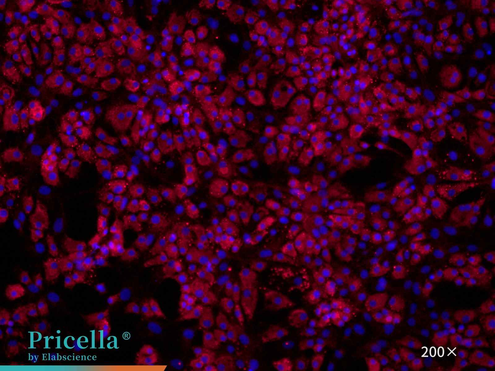 Rat Intervertebral Disc Fibroblast Cells Collagen I （200X）