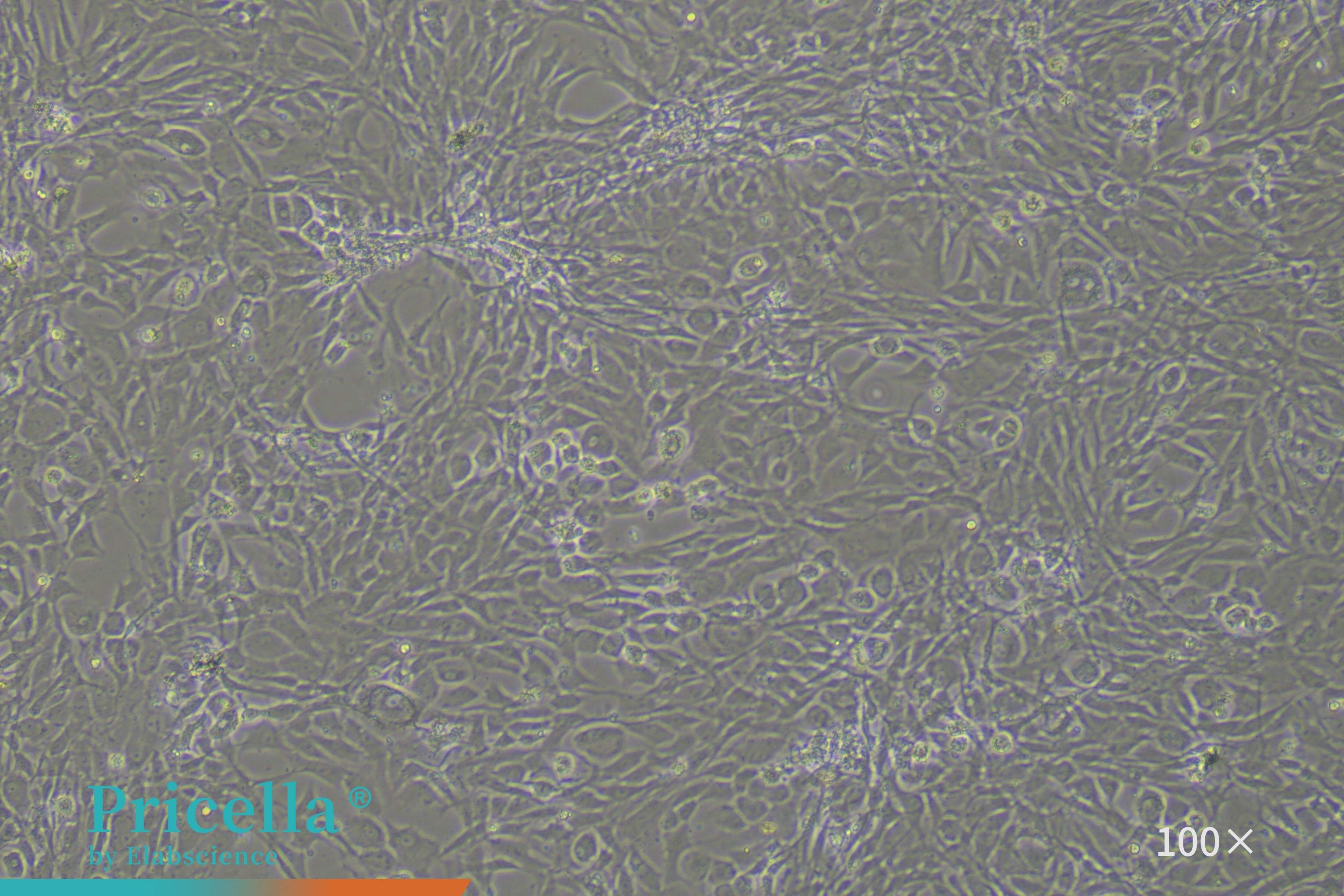 Rat Intervertebral Disc Fibroblast Cells（100X）