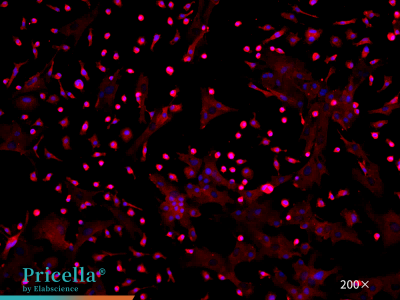 Rat Kupffer cells, CD68