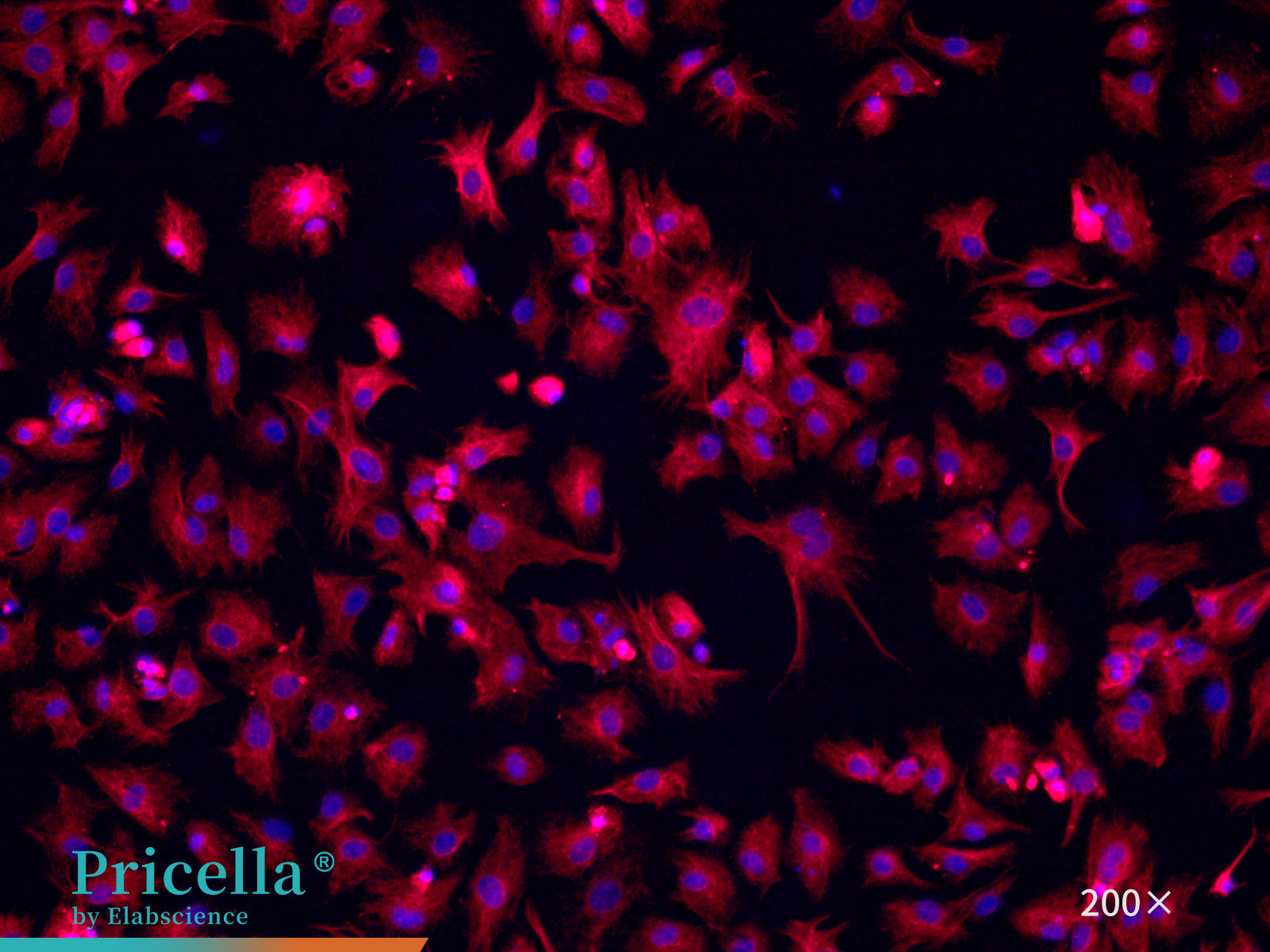 Rat cardiac fibroblasts