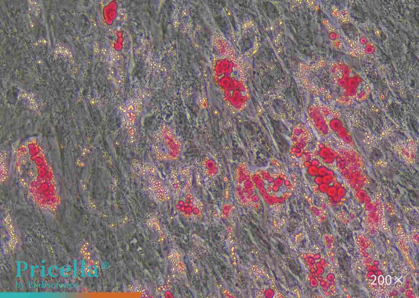 Adipogenic Differentiation hBMSCs