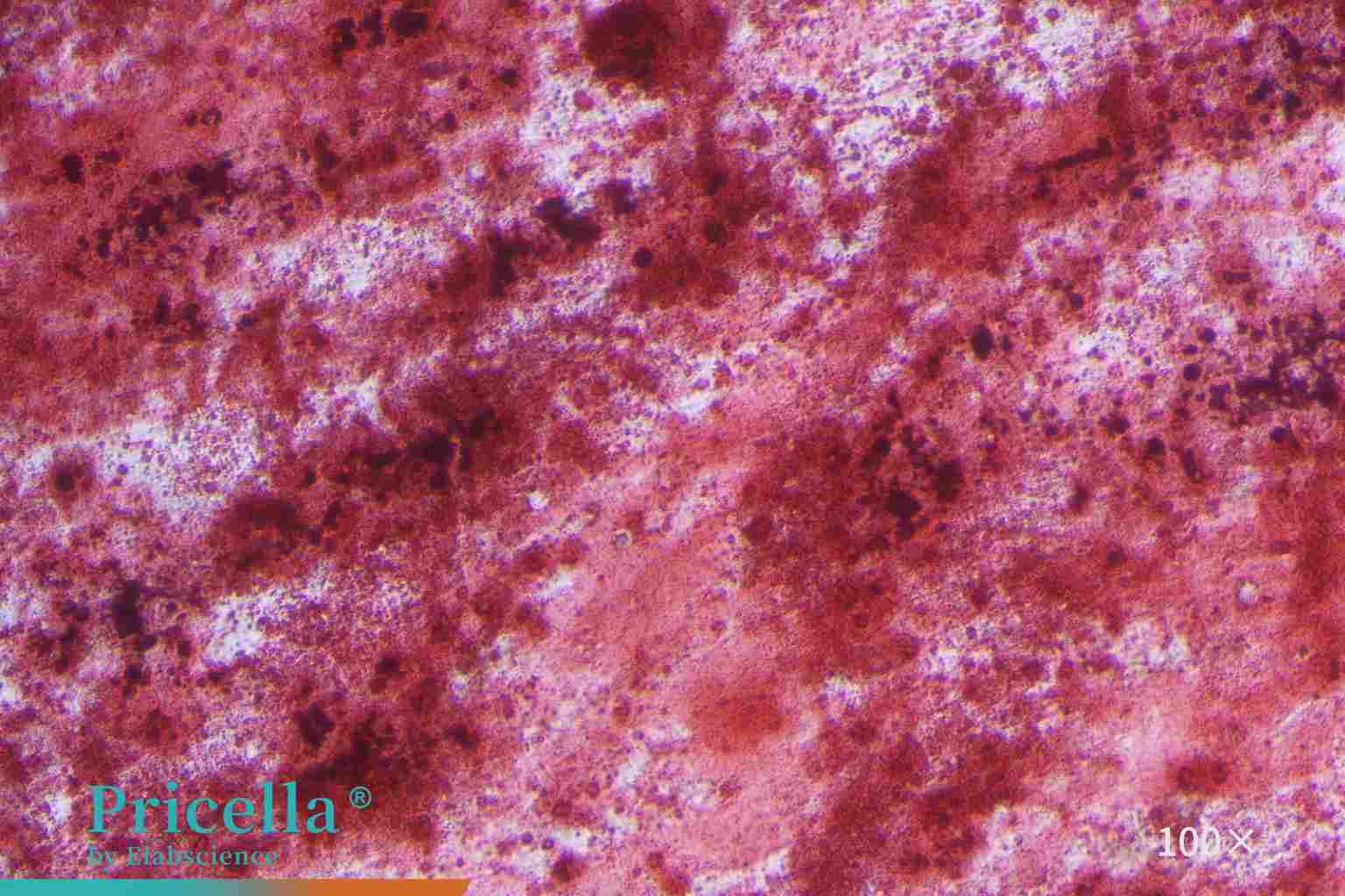 Osteogenic Differentiation hBMSCs