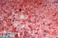 Osteogenic Differentiation rBMSCs