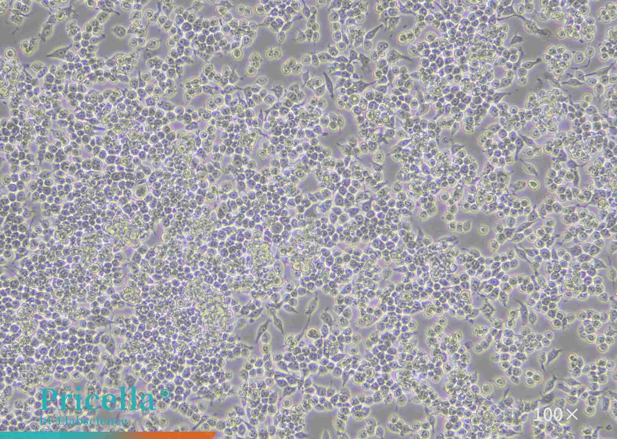 Transduction Protocol for RAW 264.7 Cells: A Complete, Ready-to-use Workflow-3