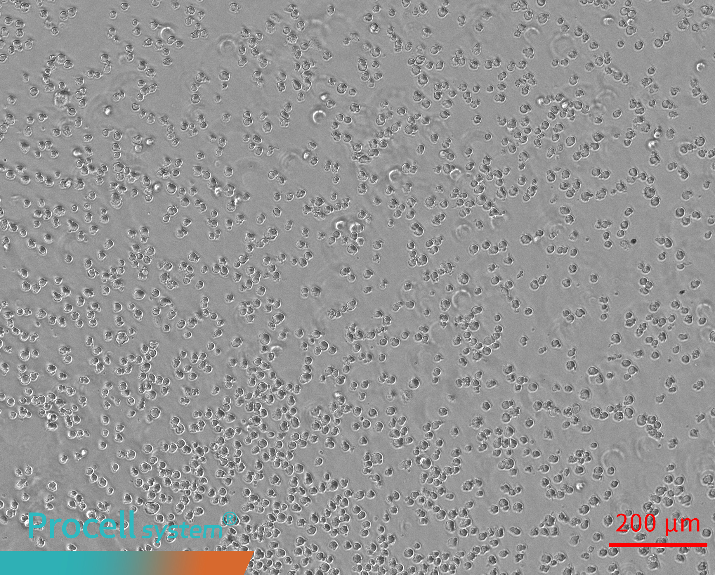 Insufficient Matrigel prevents tubular network formation 0h