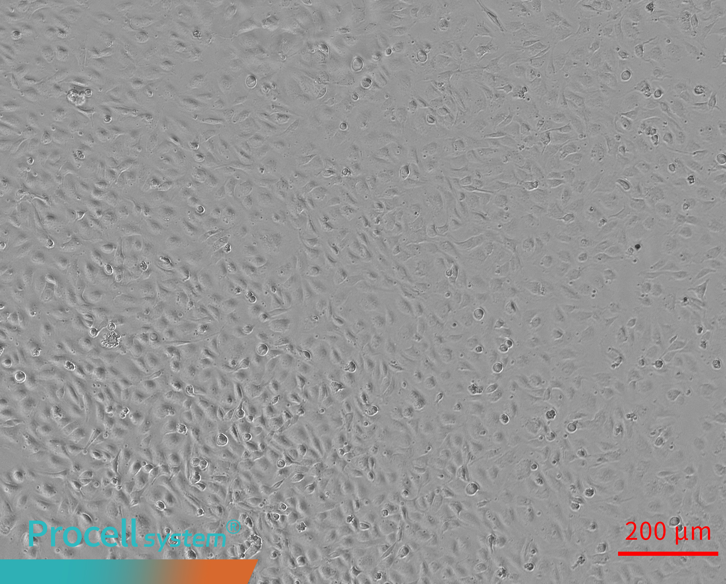 Insufficient Matrigel prevents tubular network formation 2h