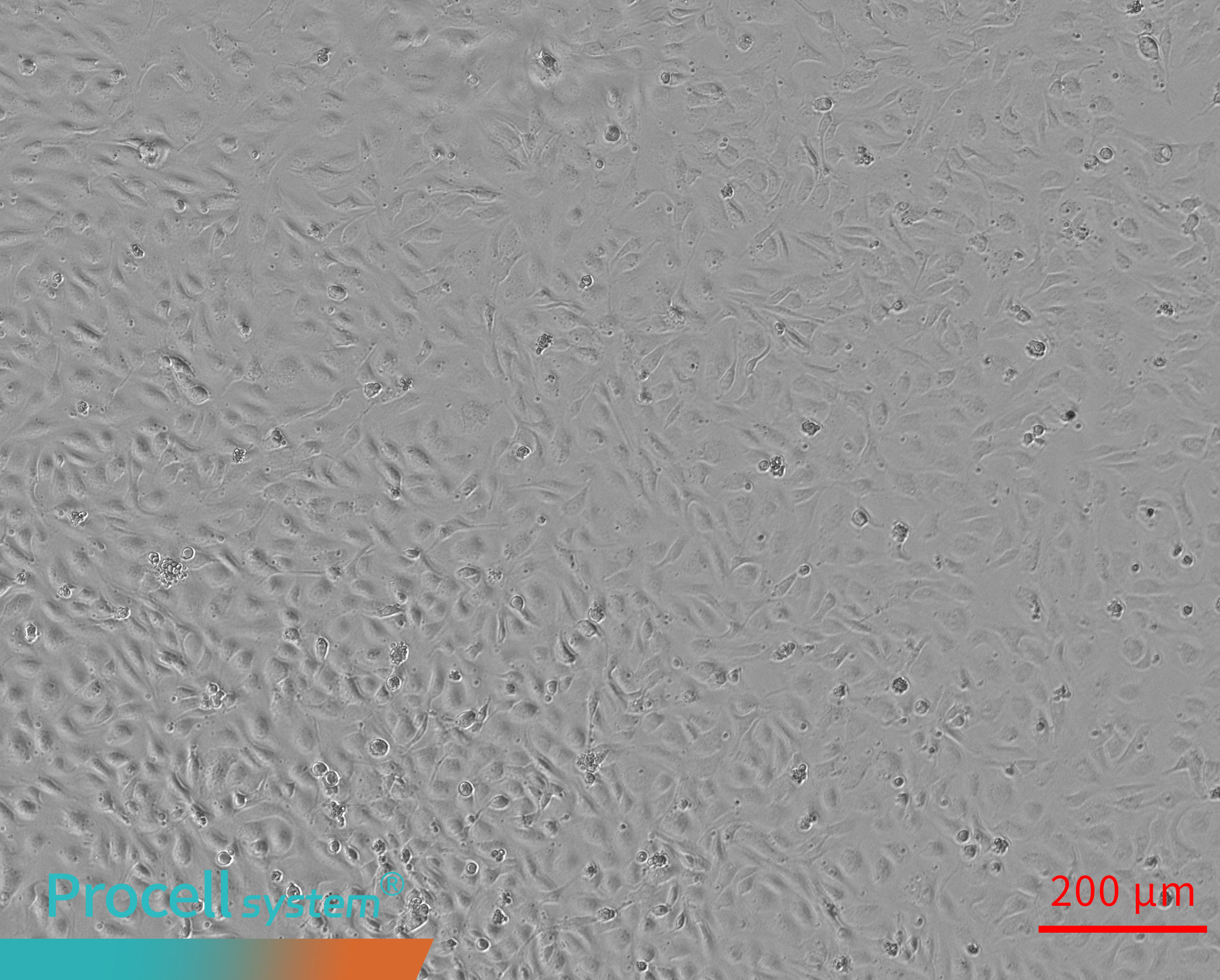 Insufficient Matrigel prevents tubular network formation 4h