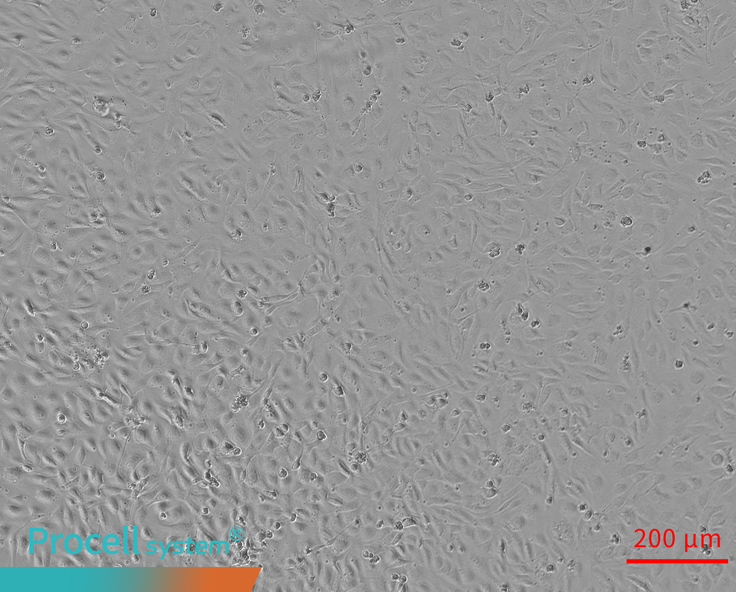 Insufficient Matrigel prevents tubular network formation 6h